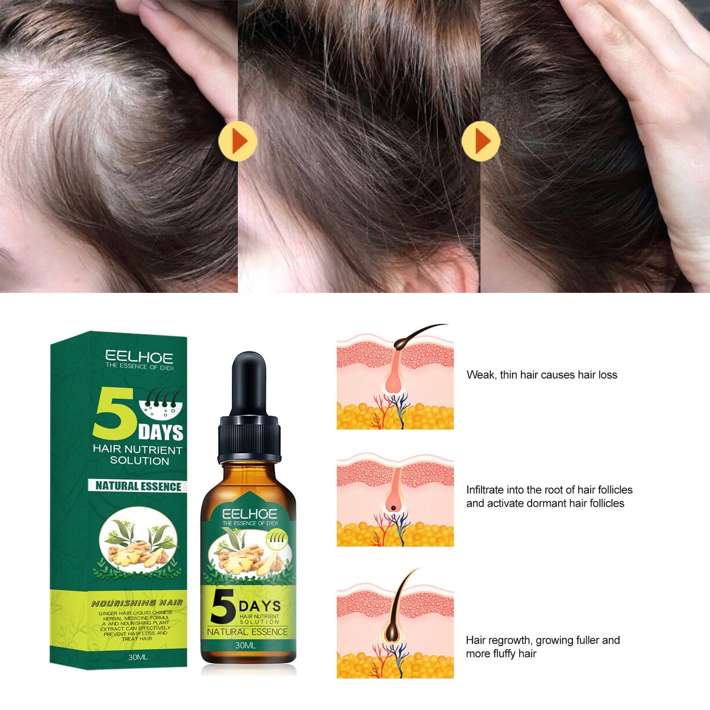 Hair growth Ginger Essential Oil.